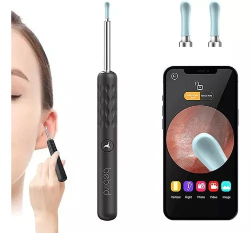 Limpiador Oido Otoscopio Inalámbrico Camara Hd Tgouy