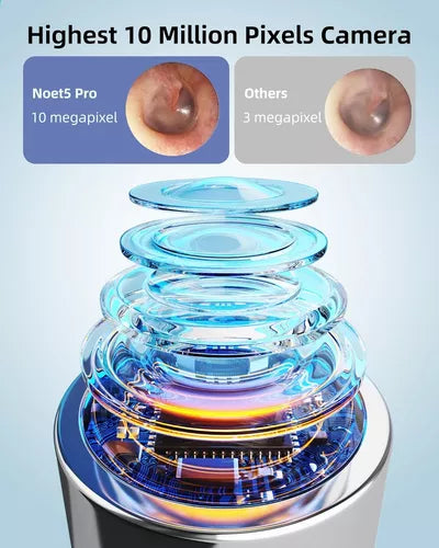 Limpiador De Oídos Para Endoscopio Con Cámara Wifi Hd
